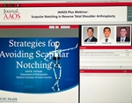 Journal of American Academy of Orthopaedic Surgeons (JAAOS) Live Webinar on Scapular Notching after Reverse Shoulder Arthroplasty